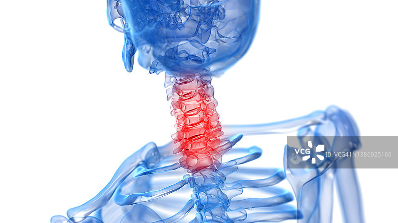 颈部疼痛插图图片素材