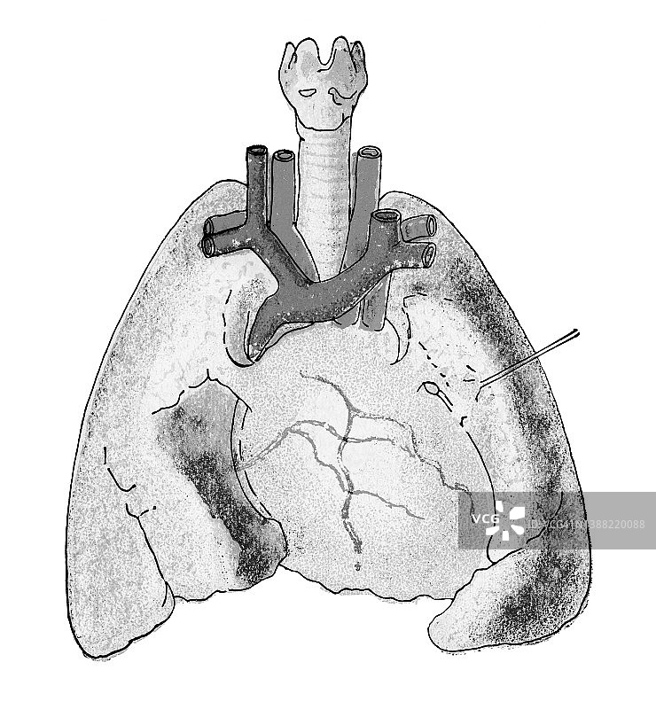 老式彩版印刷人体肺部插图图片素材