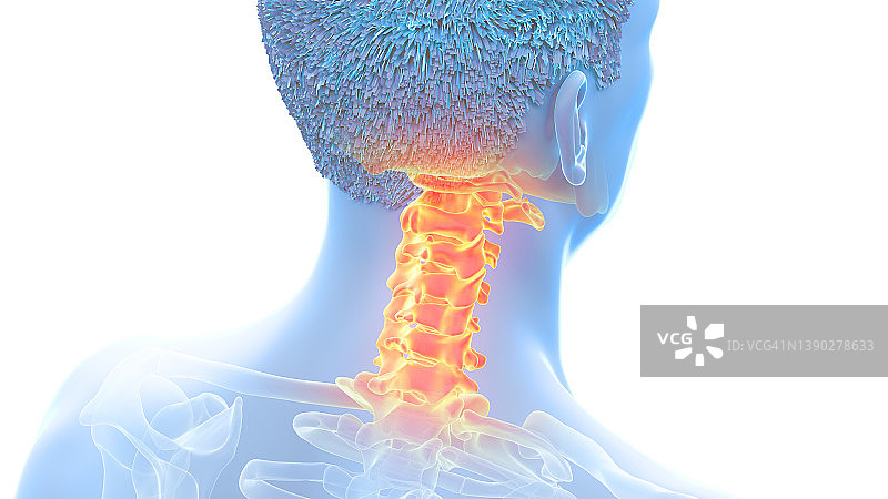 颈椎疼痛插图图片素材