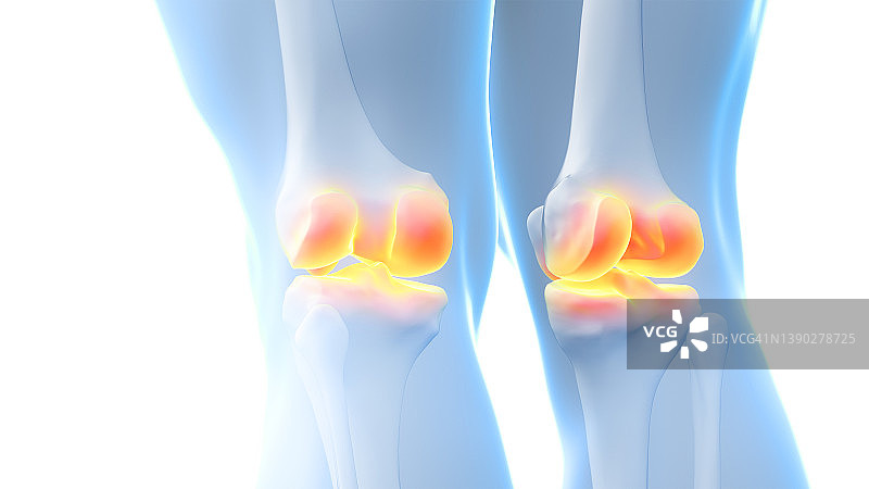 膝关节疼痛插图图片素材