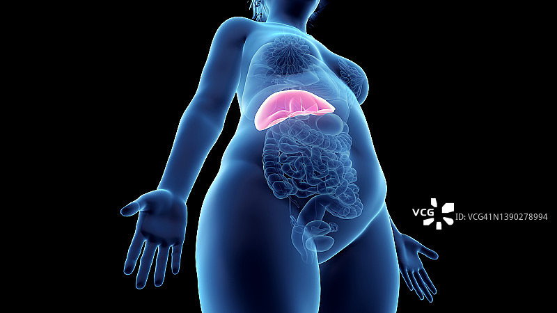 超重女人的肝脏，插图图片素材