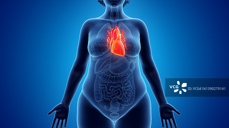 超重女人的心脏，插图图片素材