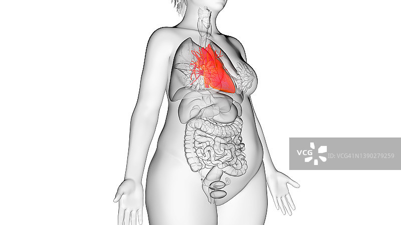 超重女人的心脏，插图图片素材