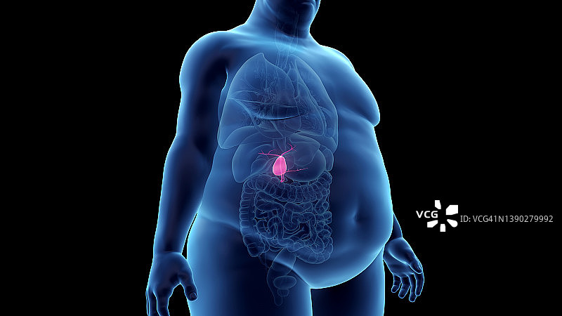 肥胖男人的胆囊，图示图片素材