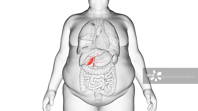 肥胖男人的胆囊，图示图片素材