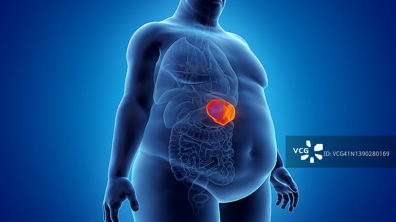 肥胖男人的脾脏，插图图片素材