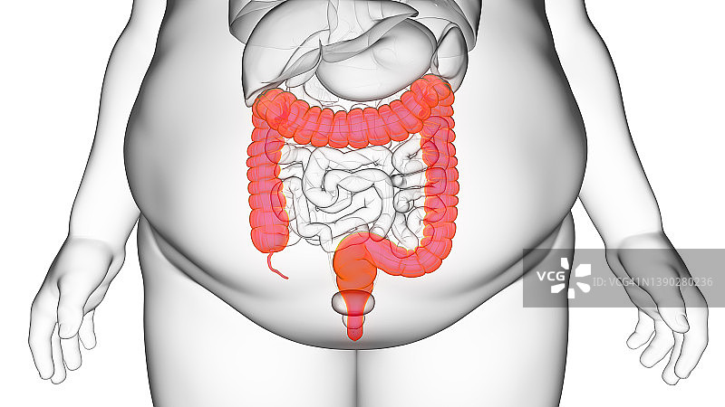 肥胖男人的结肠插图图片素材