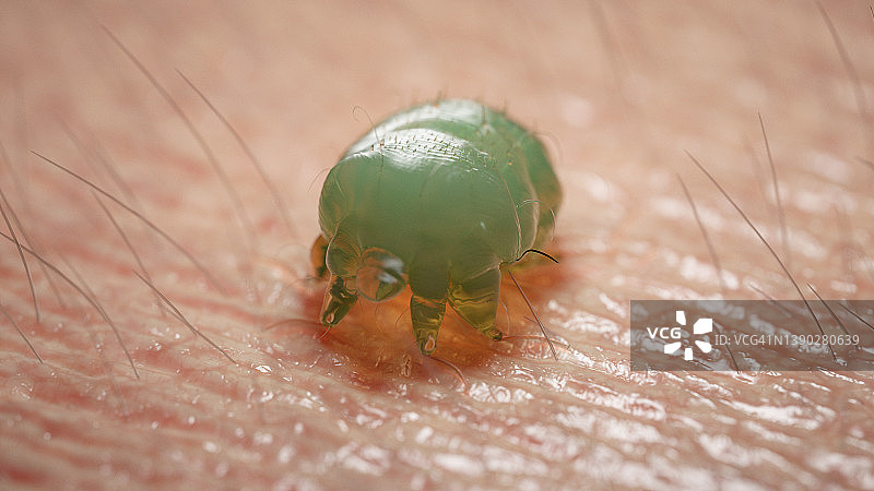 疥螨插图图片素材