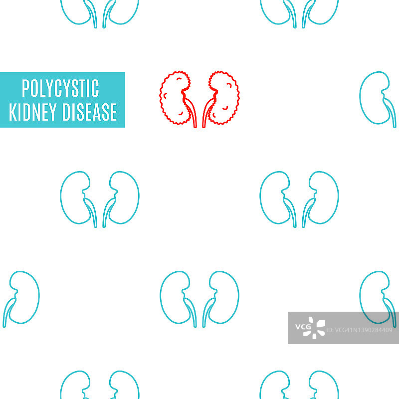 多囊肾病概念图图片素材