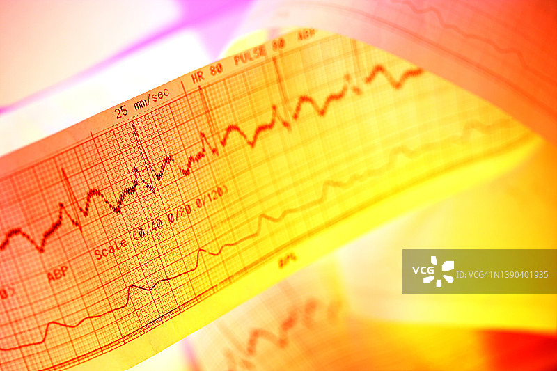 心电图特写图片素材