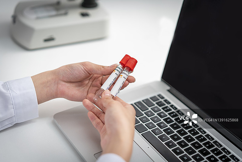 一只手拿着玻璃管图片素材