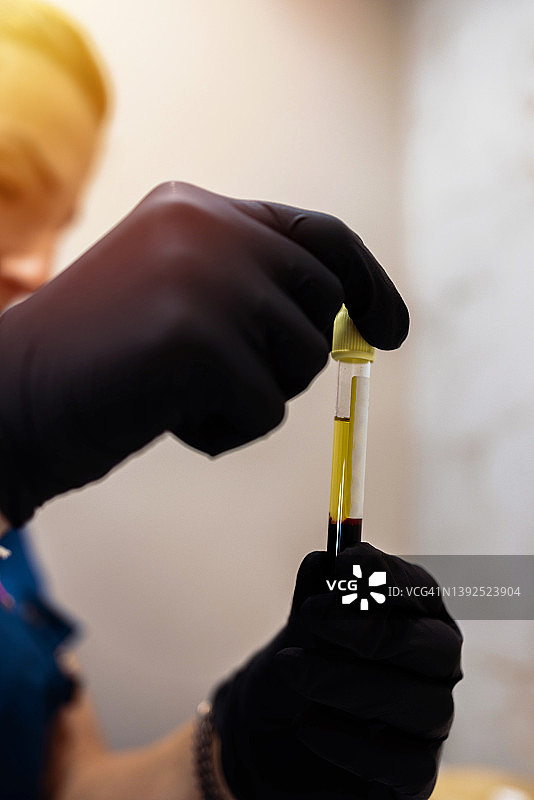 女性在实验室准备含新冠疫苗的血液样本进行检测图片素材