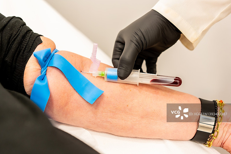 美容中心护士抽取顾客血液样本特写图片素材