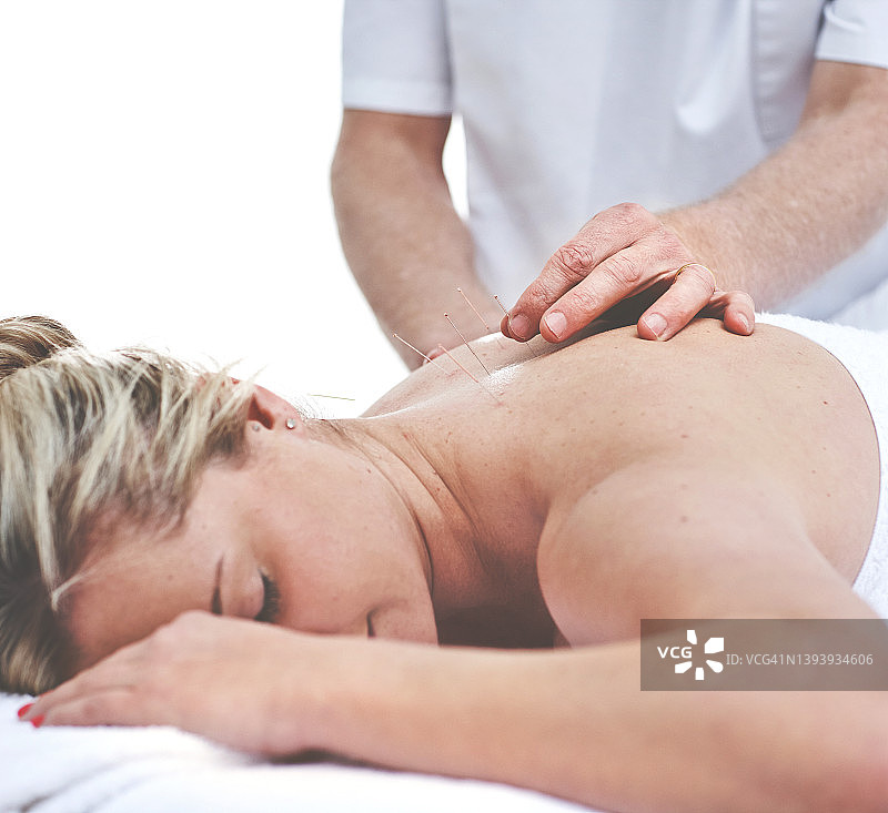 年轻女人在针灸疗程中背部被插入针，患者接受替代疗法图片素材