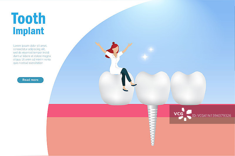 牙齿种植体、口腔医学护理概念图片素材