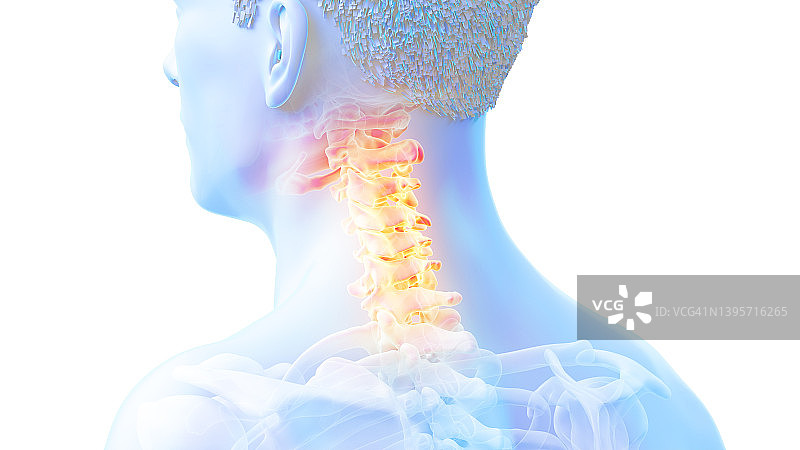 颈椎疼痛插图图片素材