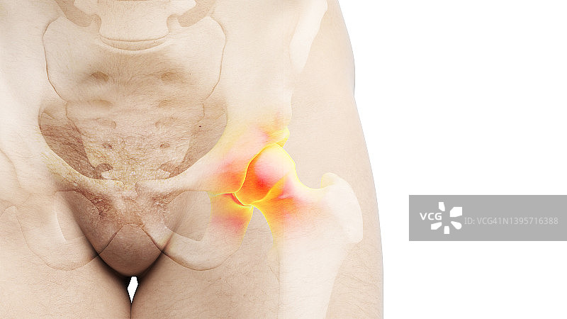 髋关节疼痛插画图片素材