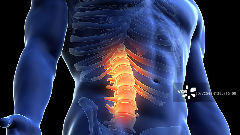 脊柱疼痛插画图片素材