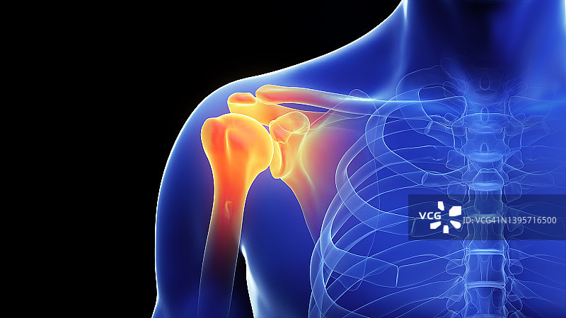 肩部疼痛插画图片素材