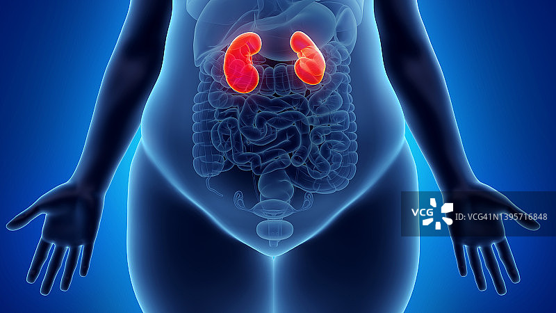 肥胖女性的肾脏图片素材