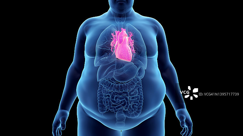 超重男人的心脏，插图图片素材