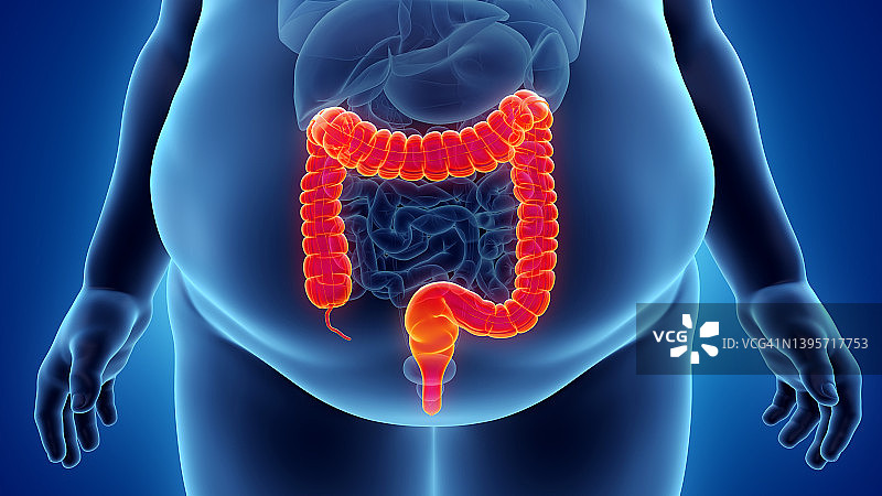 肥胖男人的结肠插图图片素材