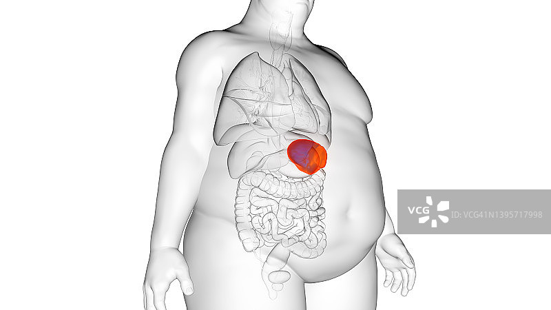 肥胖男人的脾脏，插图图片素材