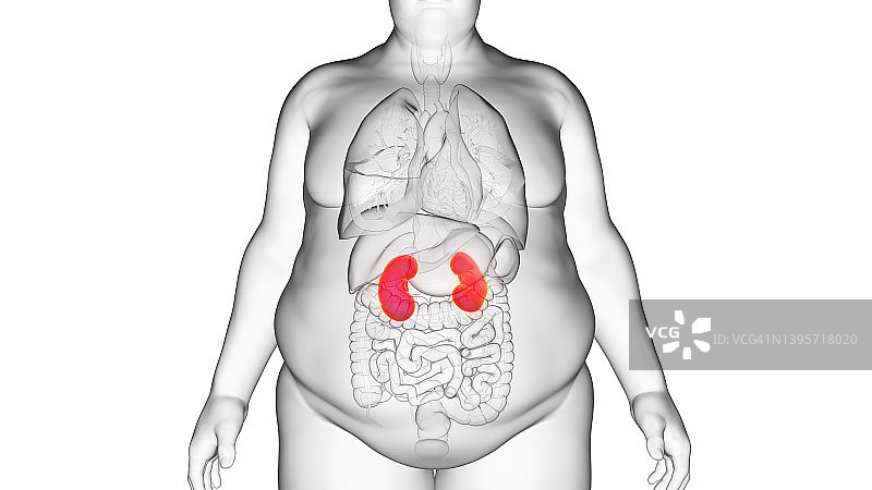 肥胖男子的肾脏，插图图片素材