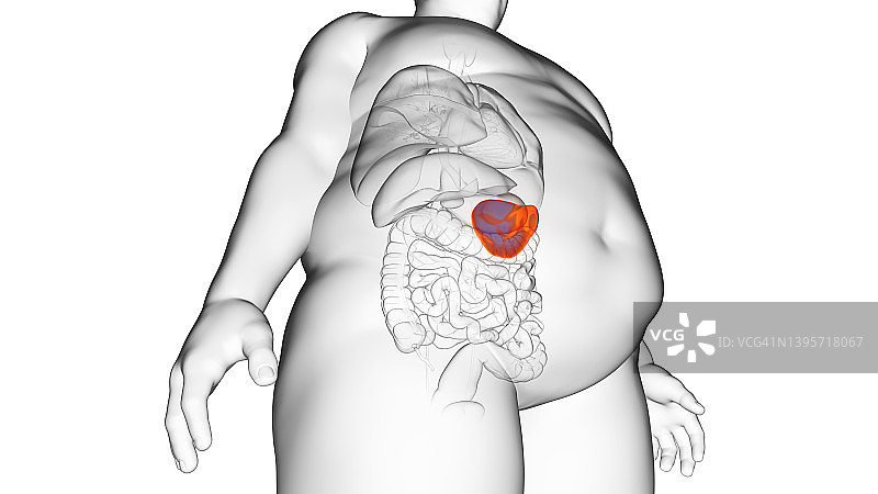肥胖男人的脾脏，插图图片素材