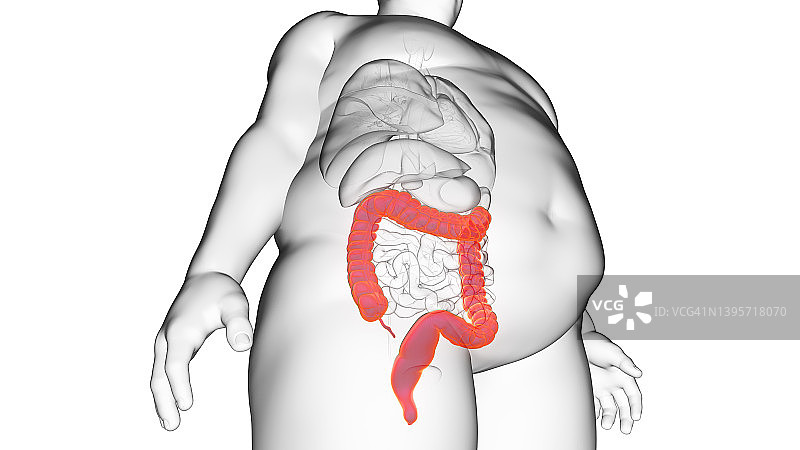 肥胖男人的结肠插图图片素材