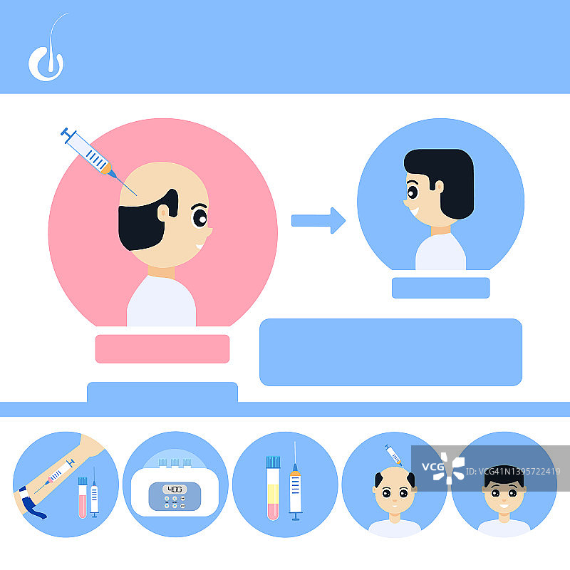 PRP男性脱发治疗插画图片素材