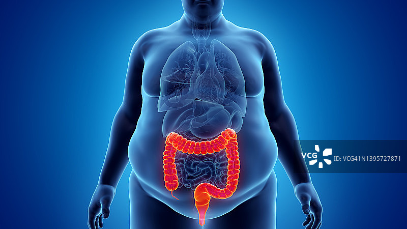 肥胖男人的结肠插图图片素材