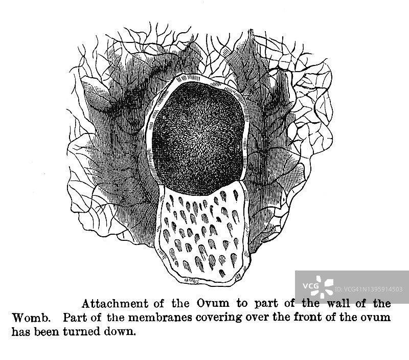 卵子附着在子宫壁上的古老雕刻插图图片素材