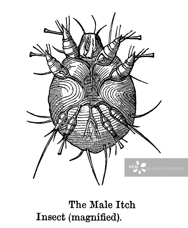 男性疥螨昆虫（Sarcoptes scabiei）的古老雕刻插图图片素材