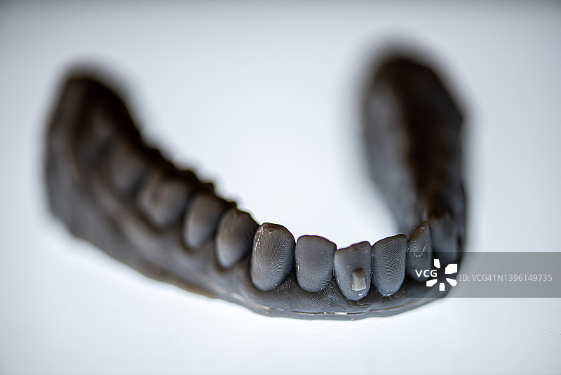 牙齿模型和矫正器图片素材