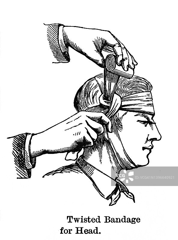 头部绷带——头部扭曲绷带老式雕刻插图图片素材