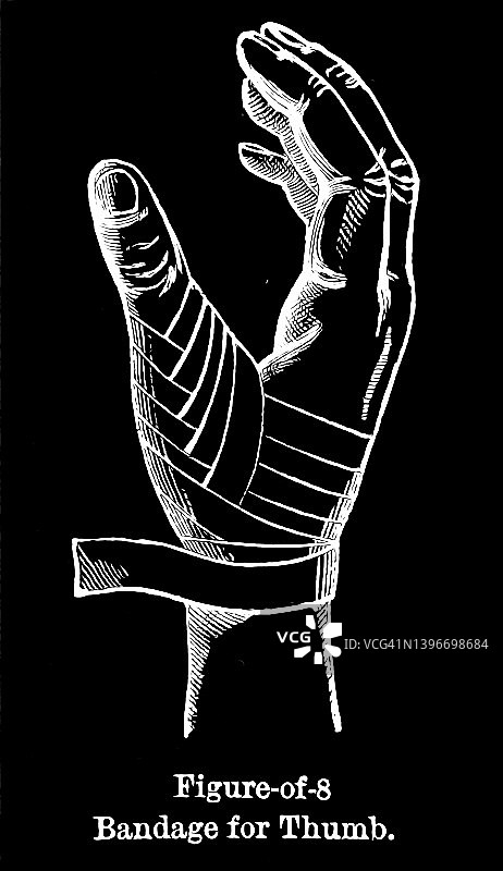 复古雕刻手指拇指绷带插画图片素材