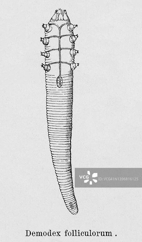 蠕形螨（毛囊蠕形螨）的复古雕刻插图图片素材