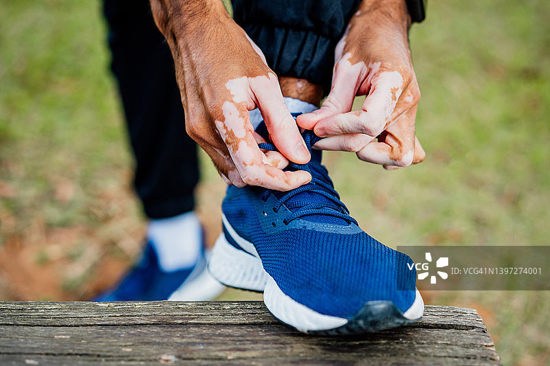 患有白癜风的男人系鞋带图片素材