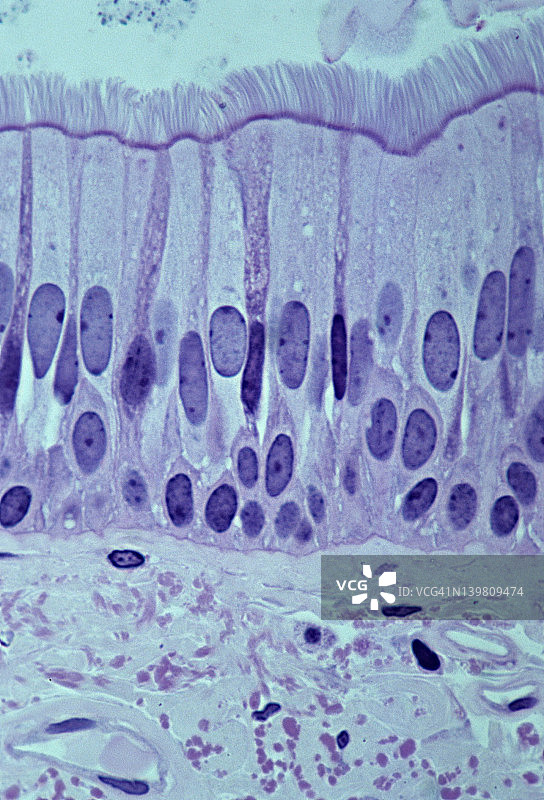 假复层纤毛柱状上皮（气管，人，250倍）图片素材