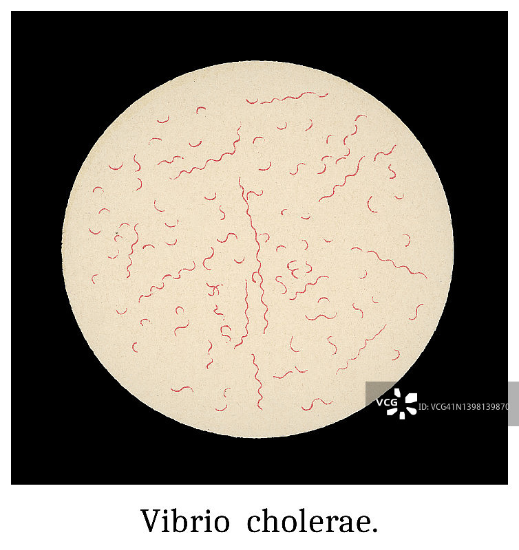 老式彩印插图：霍乱弧菌放大图图片素材