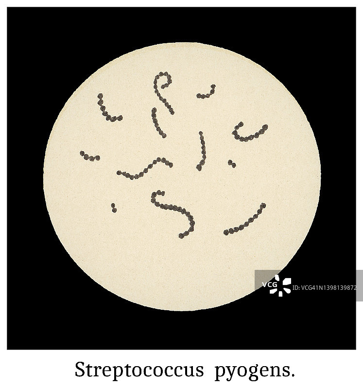 老式彩色石印插图：化脓性链球菌的放大图片素材