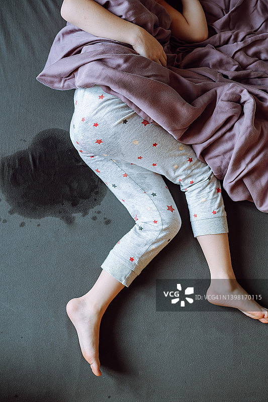 在潮湿的床上孩子的腿，尿失禁和如厕问题图片素材