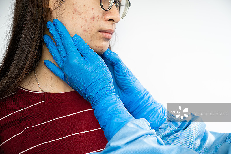 医生戴着蓝色橡胶手套触摸亚洲女性面部，检查痤疮问题的局部照片图片素材