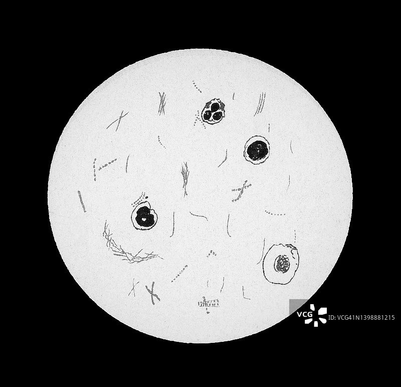 细菌结核分枝杆菌放大的古老彩色石印插图图片素材