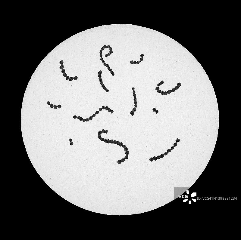 老式彩色石印插图：化脓性链球菌的放大图片素材