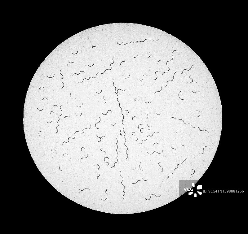 老式彩色石印插图：复发性博氏螺旋体放大图图片素材