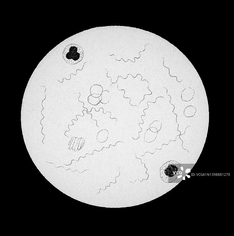 老式彩色石印插图：复发性博氏螺旋体放大图图片素材
