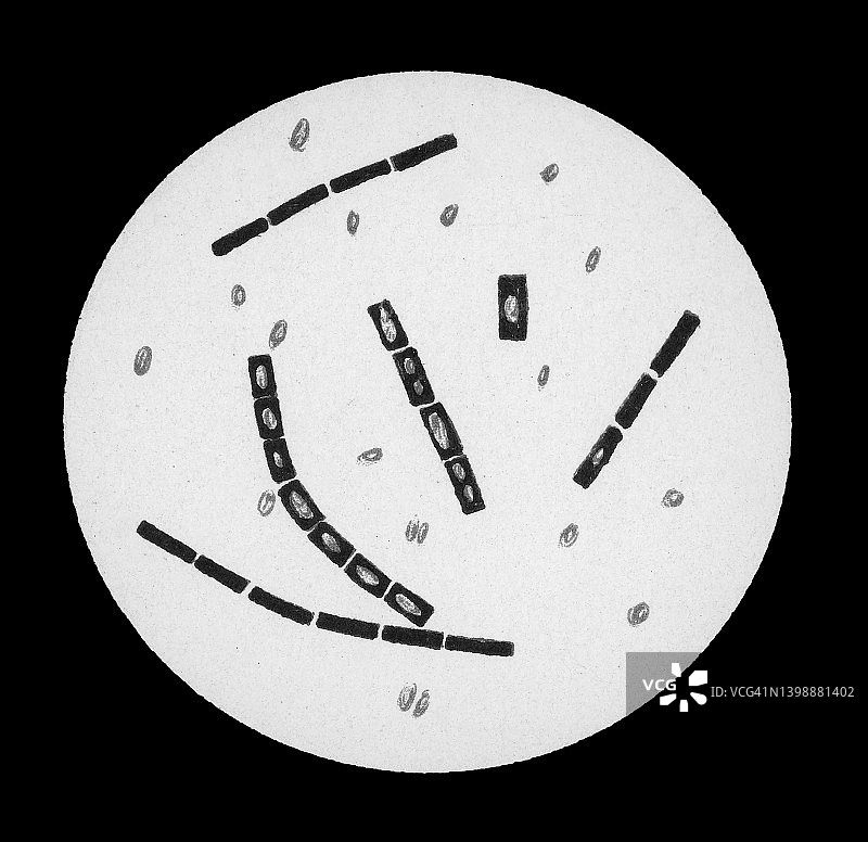 炭疽杆菌放大图古旧彩色石印插画图片素材
