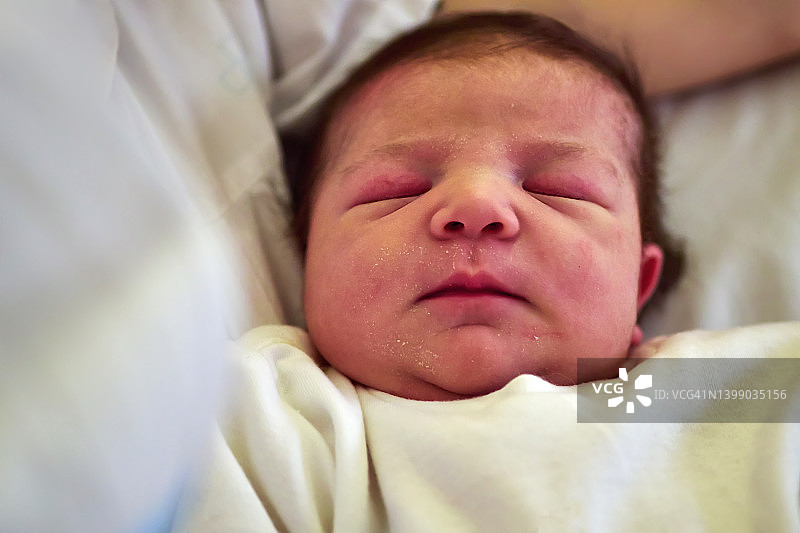 问题婴儿面部皮肤特写图片素材